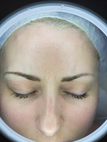 Комбинированная чистка лица - это путь к идеальной коже