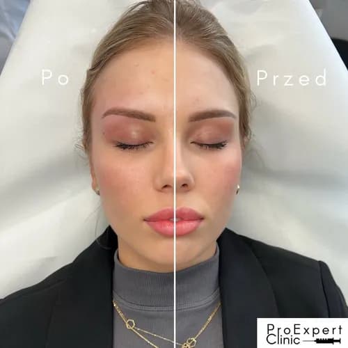 Peeling gazowo-ciekły na każdą porę roku – zdrowa skóra twarzy