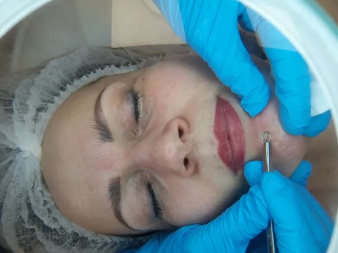 Delikatne oczyszczanie skóry dzięki atraumatycznej metodzie