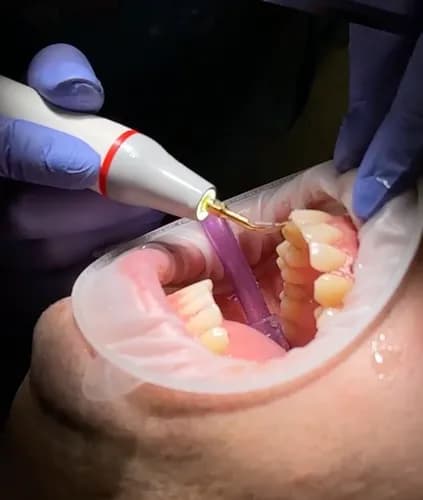 Usuwanie kamienia i osadu: Zdrowe dziąsła i świeży oddech