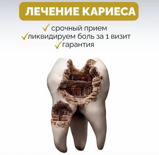 Термінове лікування карієсу та встановлення пломби у Варшаві