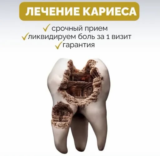 Pilne leczenie próchnicy i założenie plomby w Warszawie