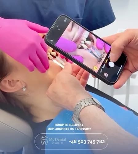 Естетична реставрація зубів — відновлення форми та кольору