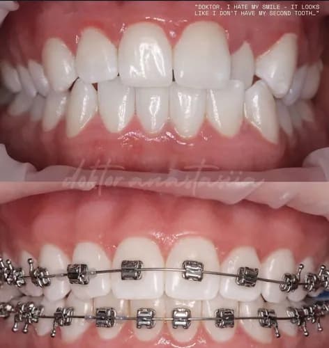 Problemy z zębami konsultacja ortodontyczna Warszawa