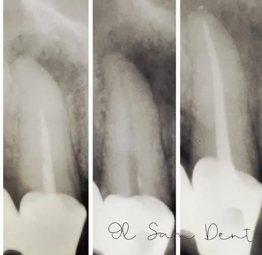 Зуб турбує - зробить прицільний знімок у Варшаві