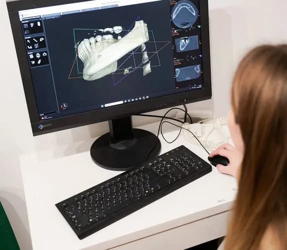 Встановлення зубної коронки під ключ у Варшаві