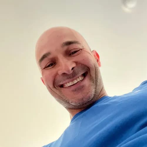 Kamień nazębny usuwanie i higienizacja stomatologiczna Warszawa