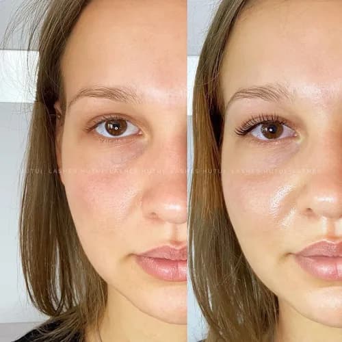 Laminowanie i klasyczne przedłużanie rzęs