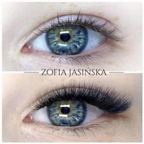 Augmentacja 3D - augmentacja zwiększająca objętość 3-krotnie