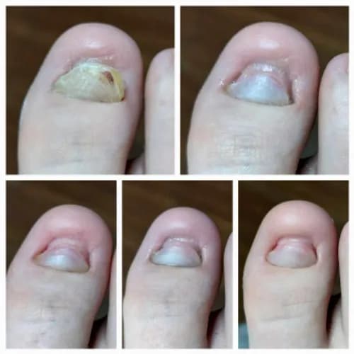 Pedicure specjalistyczny dla zdrowia i estetyki stóp