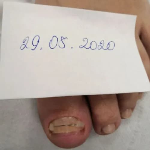 Pedicure regenerujący