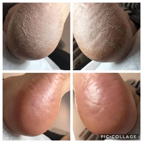 Spa - pedicure - zafunduj sobie profesjonalny zabieg.