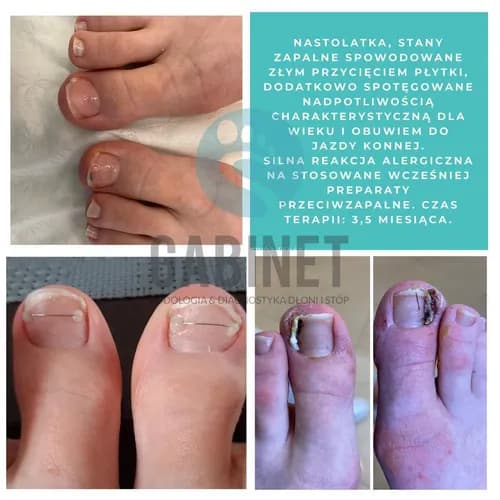 Идеальные ногти после реконструкции