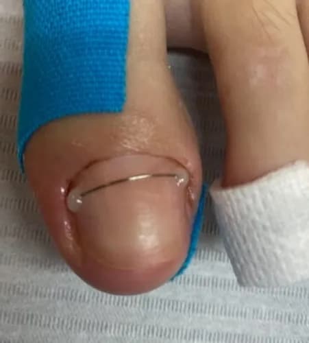 Profesjonalna protetyka krok po kroku