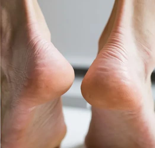 Профессиональный уход за стопами и пятками