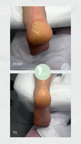 Комплексный уход за стопами