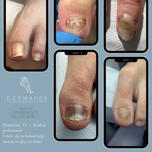 Ваши здоровые ногти в наших руках