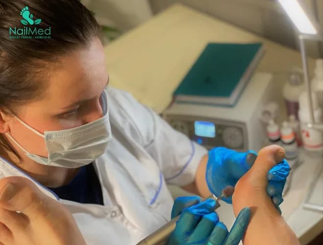 Эффективное удаление натоптышей в моем кабинете