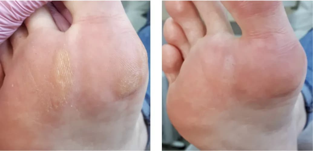 Ваши стопы в лучших руках