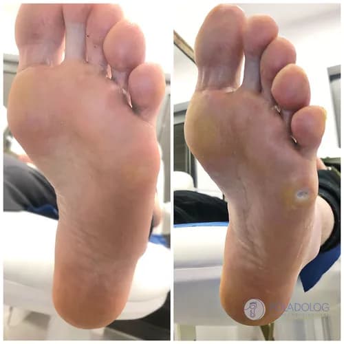 Twoje stopy odzyskają lekkość i zdrowie