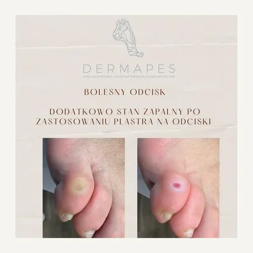 Комплексная помощь для ваших стоп в салоне