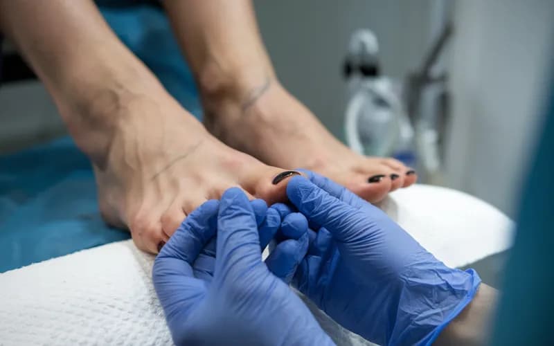 Profesjonalne leczenie paznokci