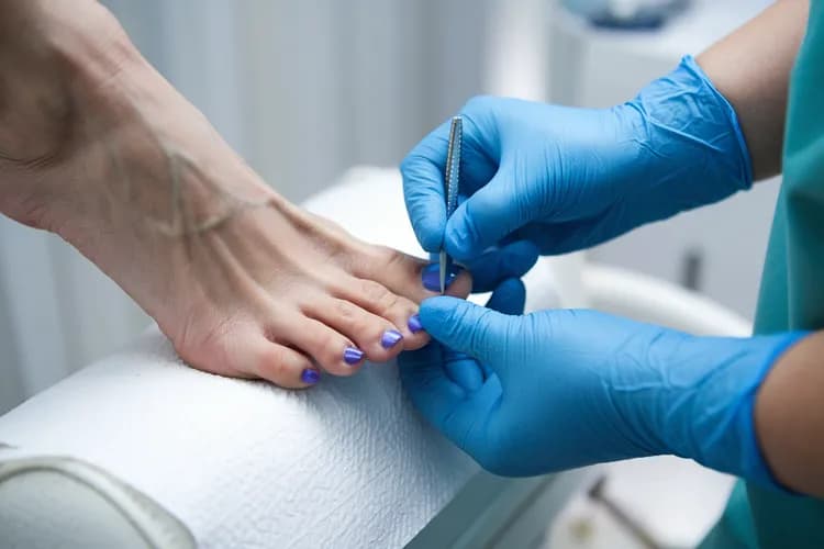 Terapia regeneracyjna dla paznokci