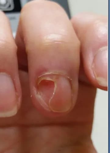 Twoje zdrowe paznokcie to nasz priorytet