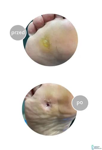 Przywracamy zdrowie i estetykę Twoim stopom