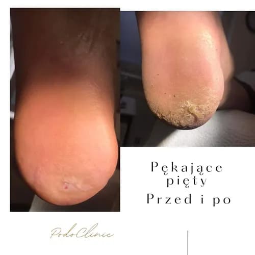 Eksperci od pięknych i zdrowych stóp