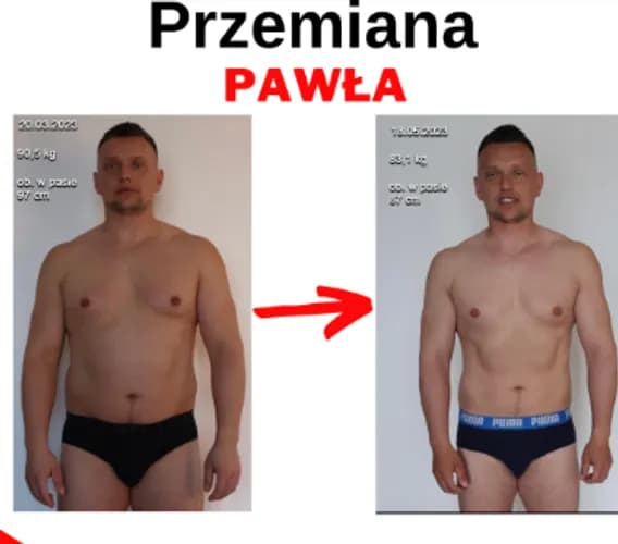 Żywienie medyczne dla zdrowia