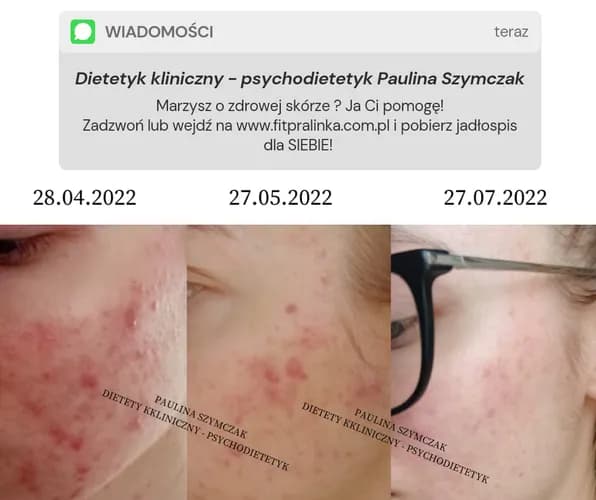 Konsultacje online dla każdego