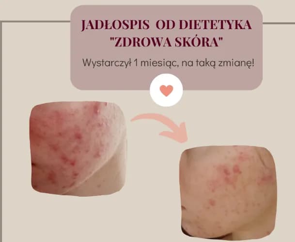 Konsultacje online dla każdego
