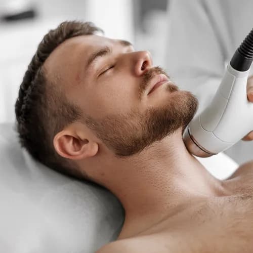 Nieskazitelny styl - depilacja laserowa dla mężczyzn