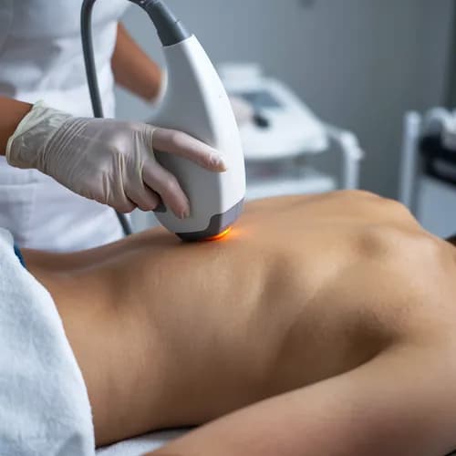 Gładkie plecy bez wysiłku – depilacja laserowa w naszym salonie!