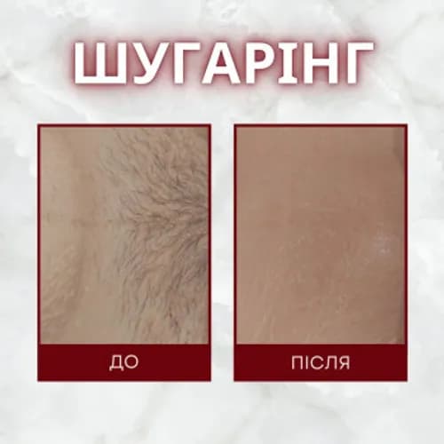 Depilacja pach z wykorzystaniem pasty cukrowej – bezpieczna i skuteczna