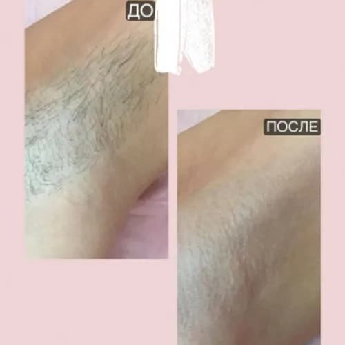 Depilacja cukrowa – prosty sposób na gładkie pachy