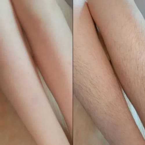 Gładkie nogi przez długi czas - depilacja cukrowa!