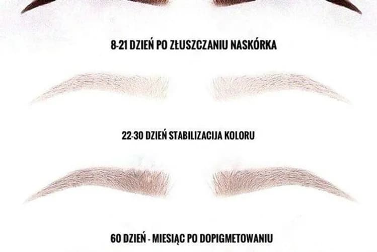 W salonie - delikatne usuwanie tatuażu