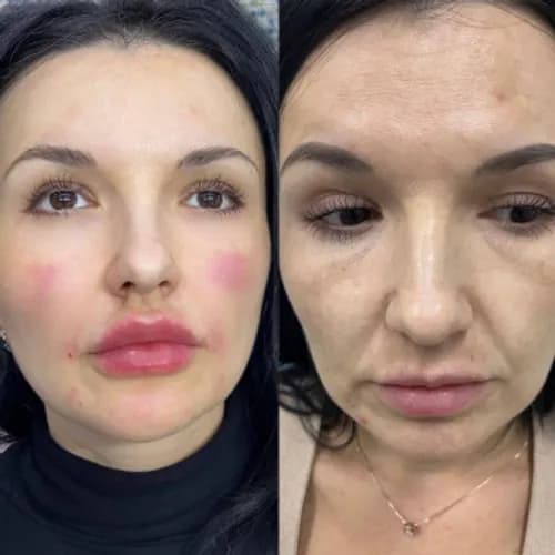 Создаю гармоничный профиль