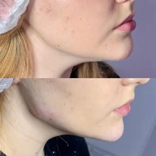 Підкреслюю грані краси