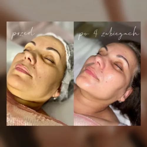 Relaks twarzy godny podziwu.