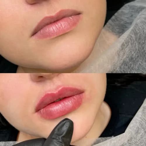 Объемные губы: профессиональное увеличение
