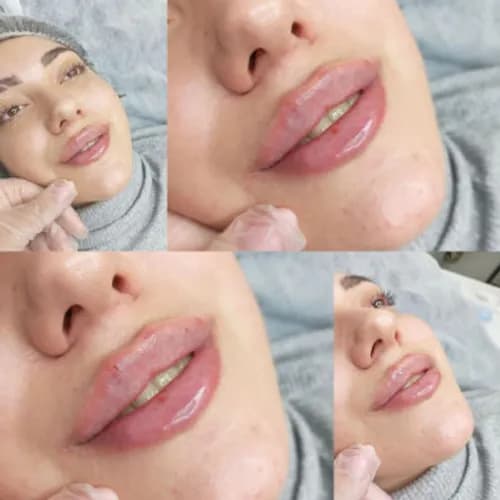 Powiększanie ust „Mój charakterystyczny styl”