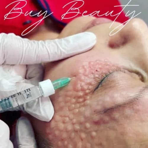 Profesjonalna biorewitalizacja: przywróć młodość i blask skórze