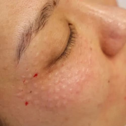 Dodaj swojej skórze młodzieńczego wigoru