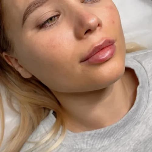 Dbamy o doskonałość skóry