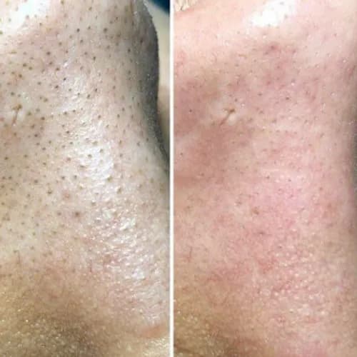 Świeży początek dla Twojej skóry - męska pielęgnacja ode mnie