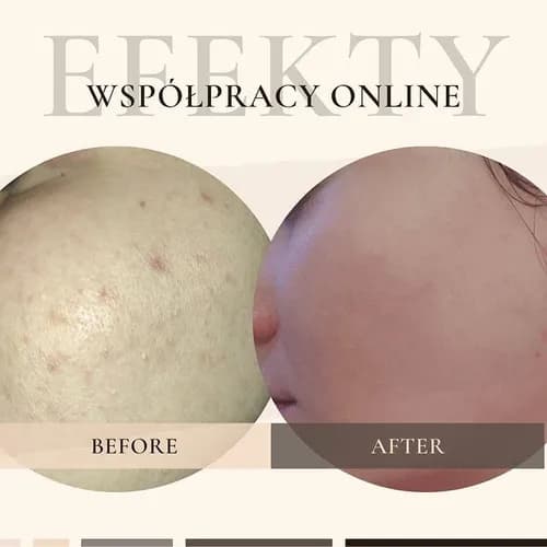 Сияние кожи без раздражения