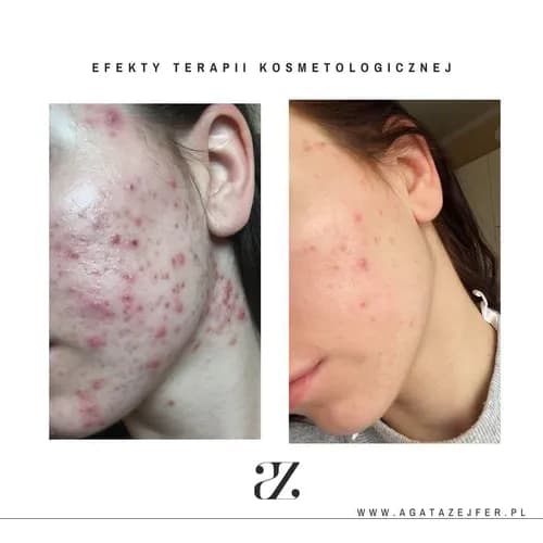 Peeling nawilżający i rozświetlający